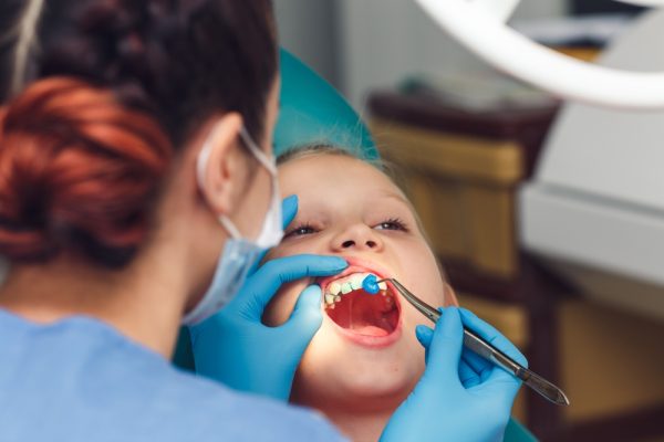 fluoride being applied to teeth