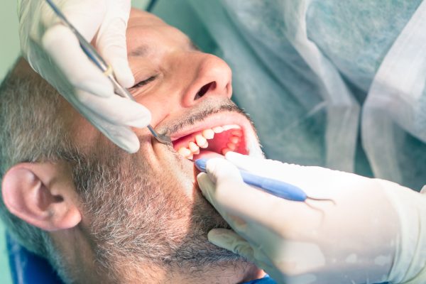 man receiving gross debridement