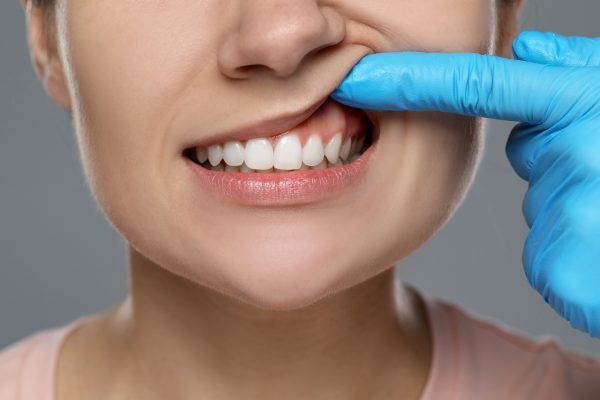 dentist examines patients gum